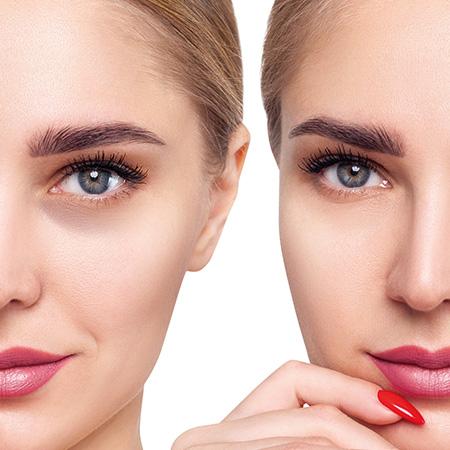 Augenkontur Roll-on 10 ml