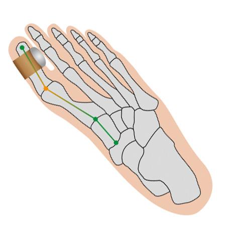 Hallux Softkissen 2er-Set